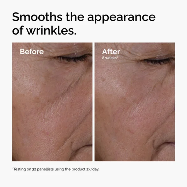 Sérum Multi-peptides + HA (« Buffet »)