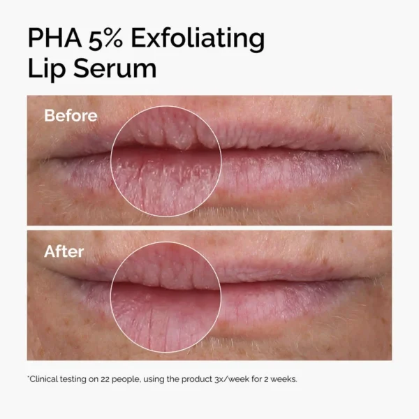 Sérum Exfoliant pour les Lèvres PHA 5%