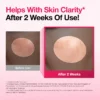 Niacinamide 10 TXA 4 Serum for Brightening and Dark Spots
