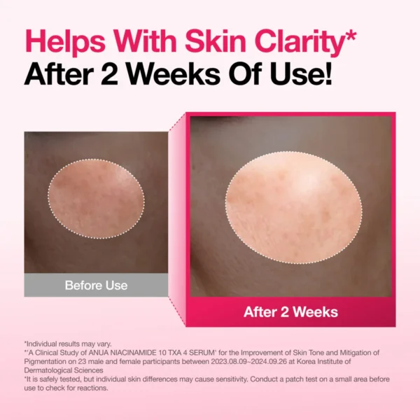 Niacinamide 10 TXA 4 Serum for Brightening and Dark Spots