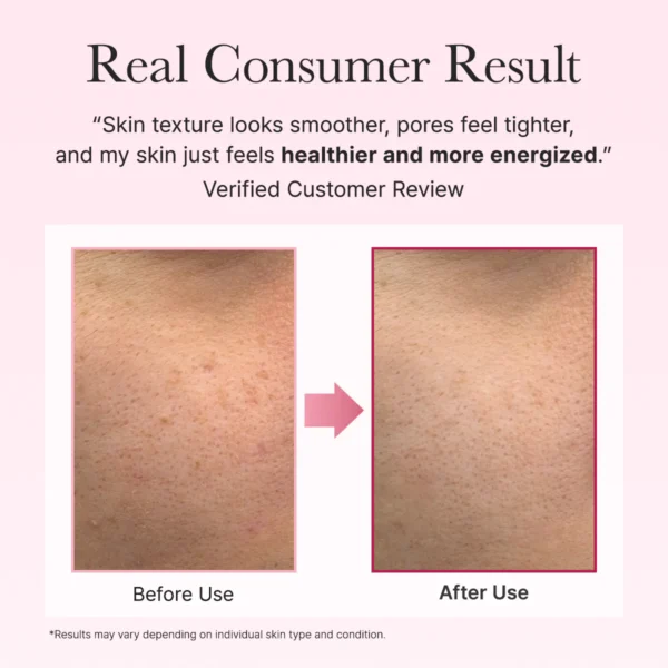 PDRN Booster Shot Rosy-PDRN & Peptides for Glowy