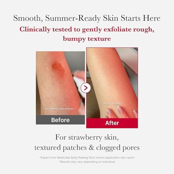 Red Acne Body Peeling Shot